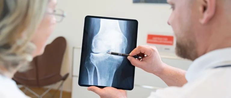 Arthrose Behandlung München